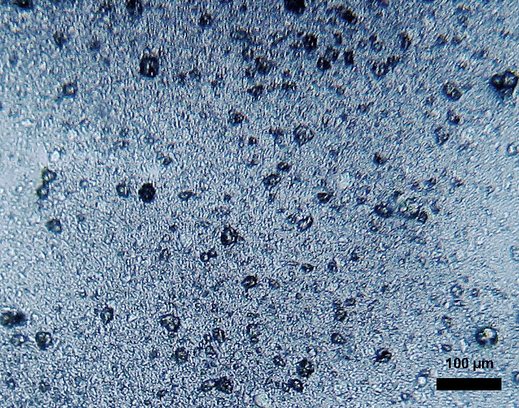 Polyethylene based microspherules in toothpaste. "Mikroplastasarp" by Dantor (talk) 20:55, 18 November 2013 (UTC) - Own work. Licensed under CC BY-SA 3.0 via Wikimedia Commons.